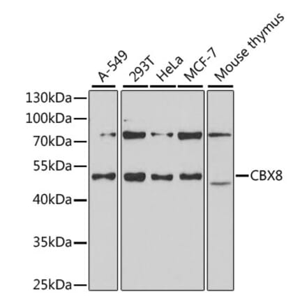 Western Blot - Anti-Cbx8 Antibody (A15115) - Antibodies.com