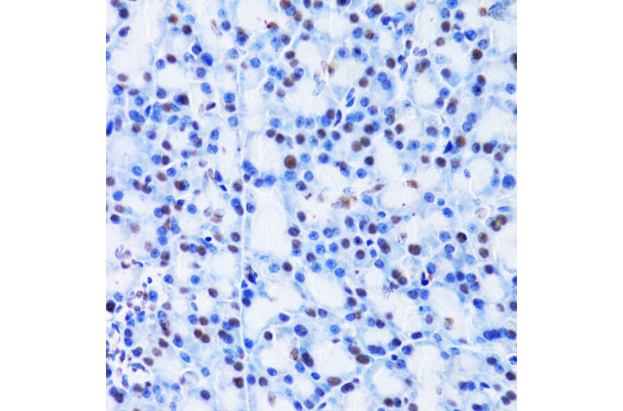 Immunohistochemistry - Anti-Cbx8 Antibody (A15115) - Antibodies.com