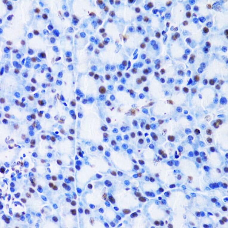 Immunohistochemistry - Anti-Cbx8 Antibody (A15115) - Antibodies.com