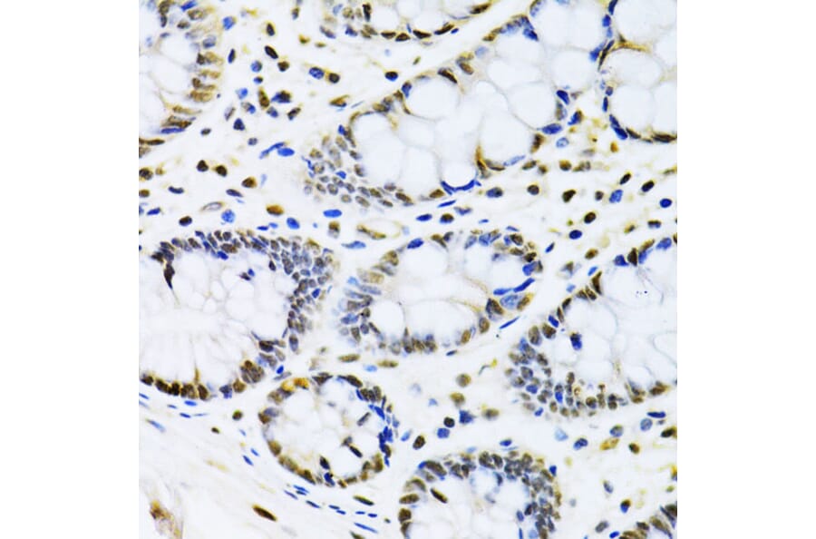 Immunohistochemistry - Anti-Cbx8 Antibody (A15115) - Antibodies.com