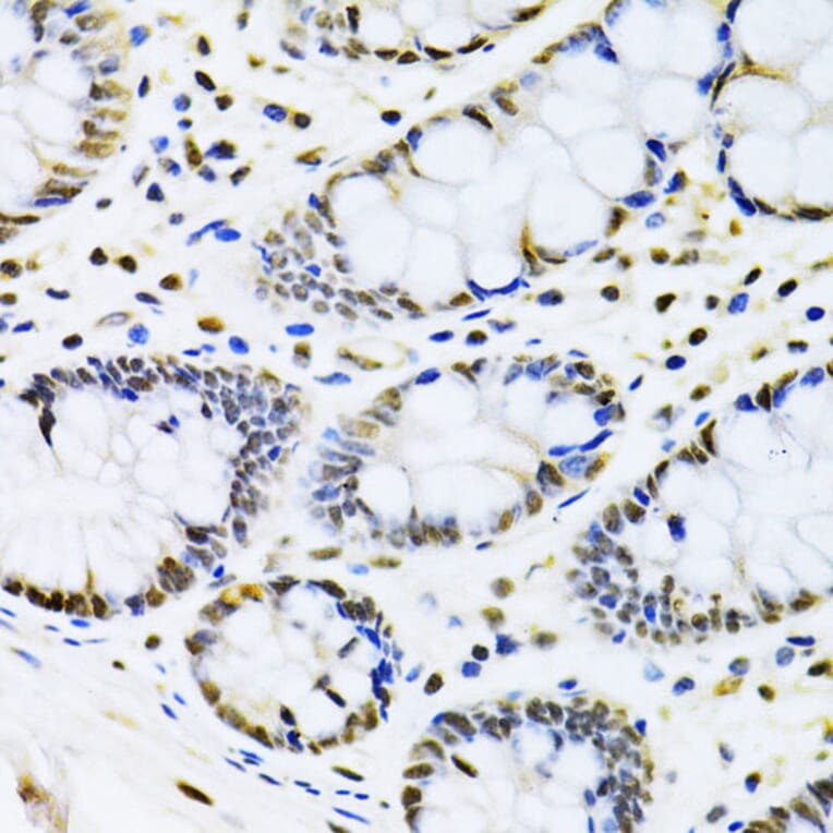 Immunohistochemistry - Anti-Cbx8 Antibody (A15115) - Antibodies.com