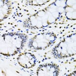 Immunohistochemistry - Anti-Cbx8 Antibody (A15115) - Antibodies.com