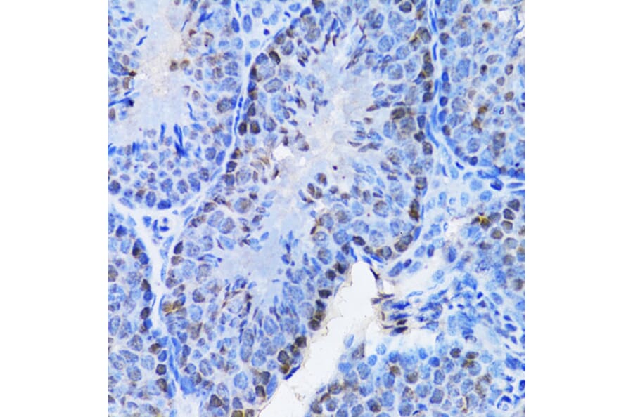 Immunohistochemistry - Anti-Cbx8 Antibody (A15115) - Antibodies.com