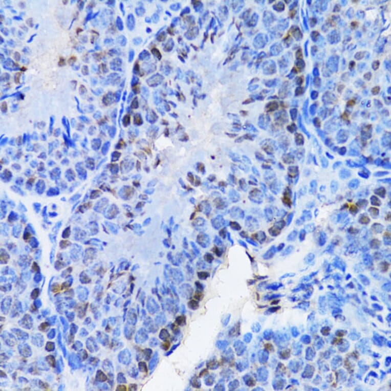 Immunohistochemistry - Anti-Cbx8 Antibody (A15115) - Antibodies.com