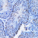 Immunohistochemistry - Anti-Cbx8 Antibody (A15115) - Antibodies.com