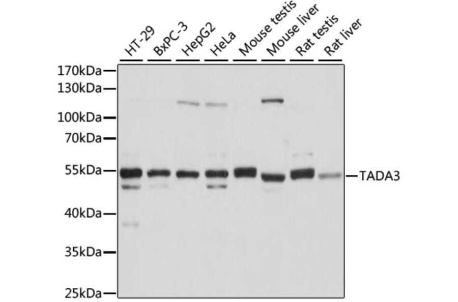 Western Blot - Anti-TADA3L Antibody (A15116) - Antibodies.com