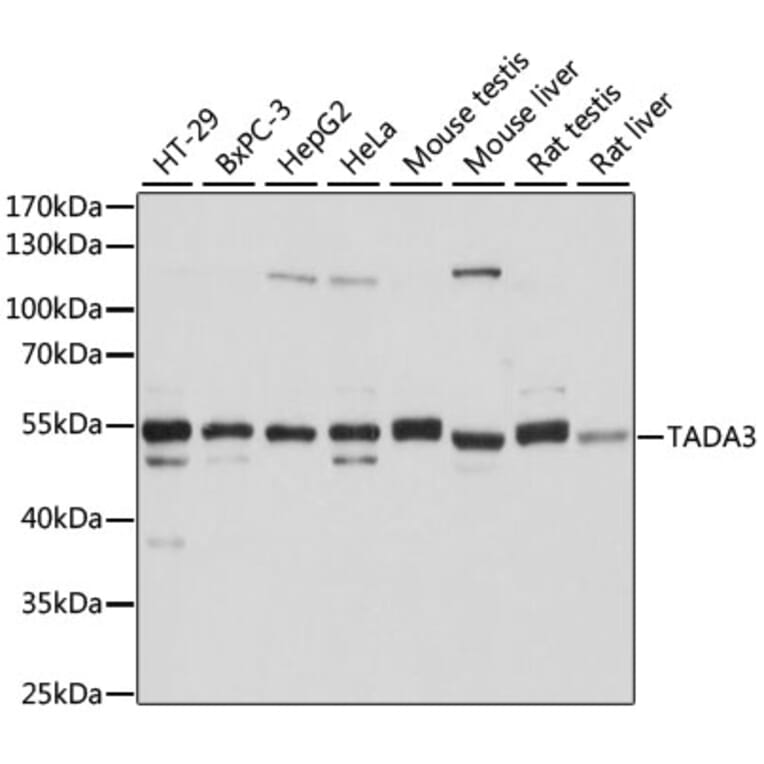 Western Blot - Anti-TADA3L Antibody (A15116) - Antibodies.com