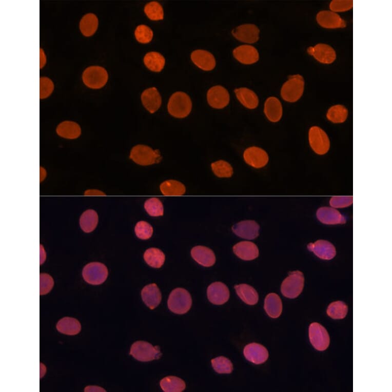 Immunofluorescence - Anti-TADA3L Antibody (A15116) - Antibodies.com