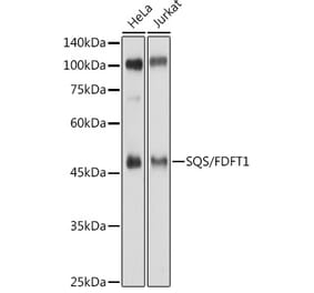 Western Blot - Anti-FDFT1 Antibody (A15117) - Antibodies.com