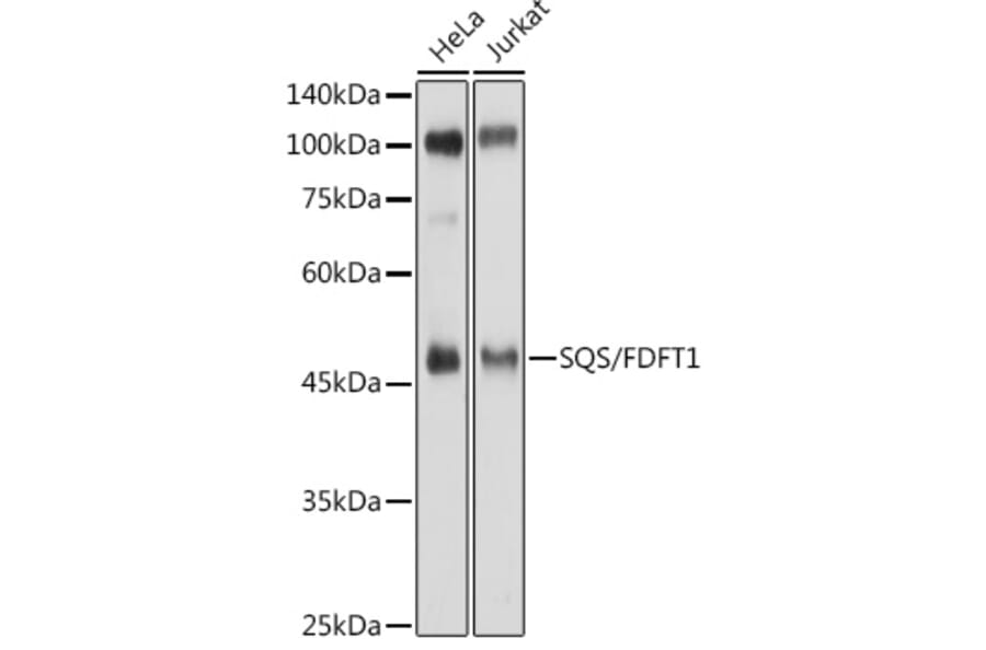 Western Blot - Anti-FDFT1 Antibody (A15117) - Antibodies.com