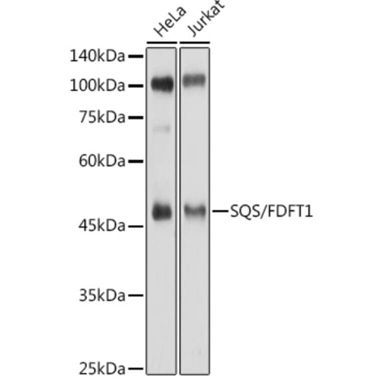 Western Blot - Anti-FDFT1 Antibody (A15117) - Antibodies.com