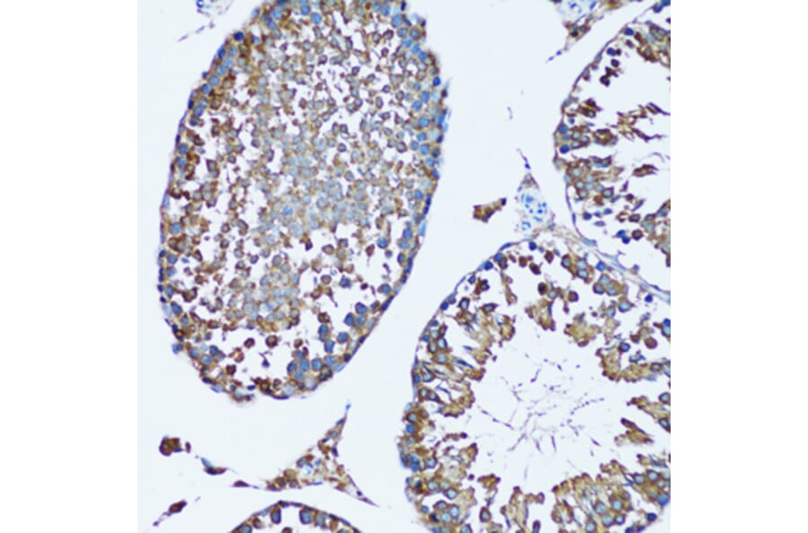 Immunohistochemistry - Anti-FDFT1 Antibody (A15117) - Antibodies.com