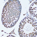 Immunohistochemistry - Anti-FDFT1 Antibody (A15117) - Antibodies.com