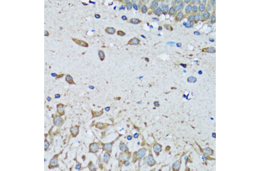 Immunohistochemistry - Anti-FDFT1 Antibody (A15117) - Antibodies.com
