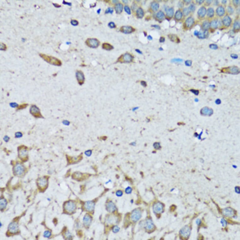 Immunohistochemistry - Anti-FDFT1 Antibody (A15117) - Antibodies.com