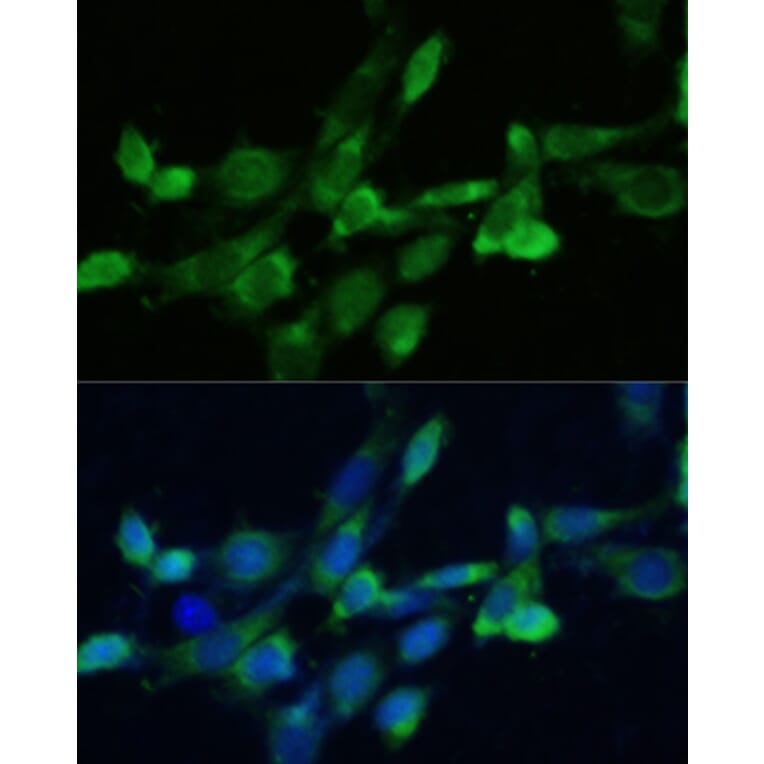 Immunofluorescence - Anti-FDFT1 Antibody (A15117) - Antibodies.com