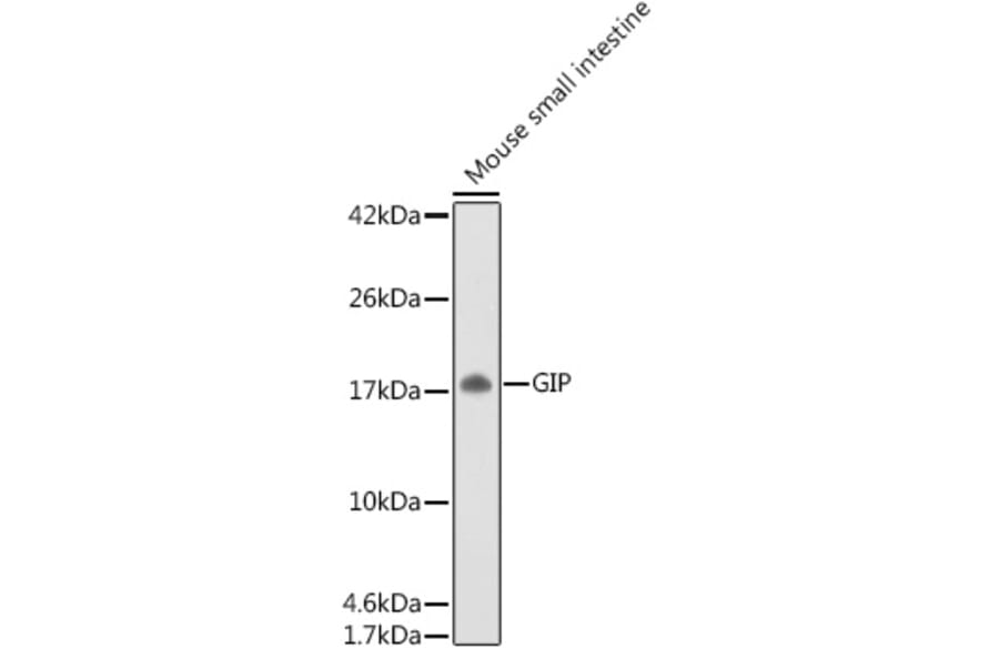 Western Blot - Anti-GIP Antibody (A15118) - Antibodies.com