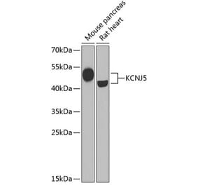 Western Blot - Anti-KCNJ5 Antibody (A15119) - Antibodies.com
