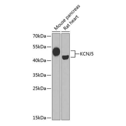 Western Blot - Anti-KCNJ5 Antibody (A15119) - Antibodies.com