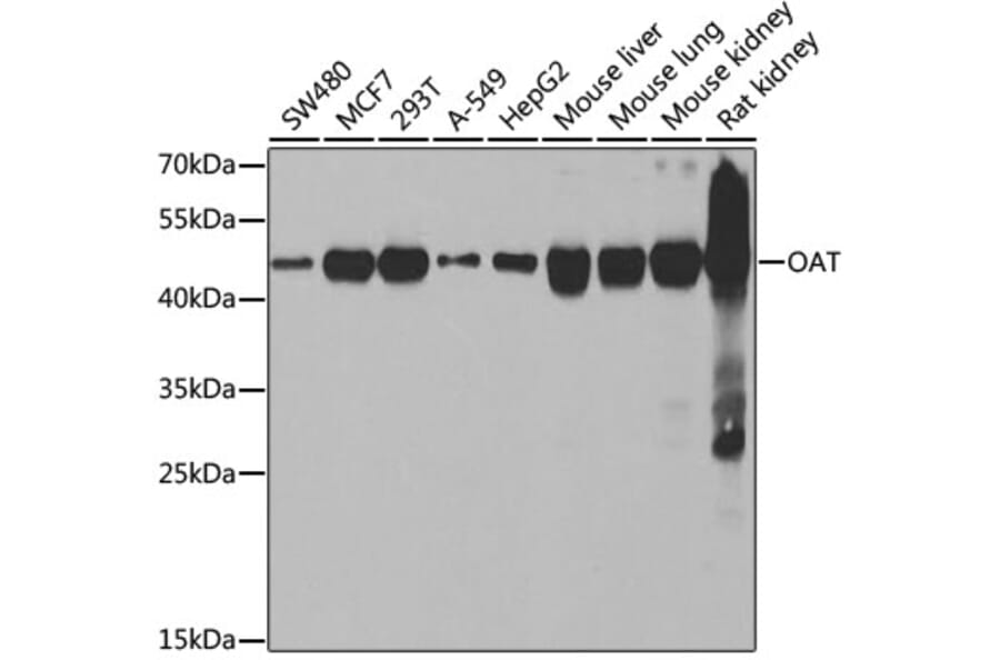 Western Blot - Anti-ornithine aminotransferase Antibody (A15120) - Antibodies.com