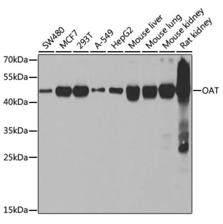 Western Blot - Anti-ornithine aminotransferase Antibody (A15120) - Antibodies.com