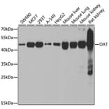 Western Blot - Anti-ornithine aminotransferase Antibody (A15120) - Antibodies.com