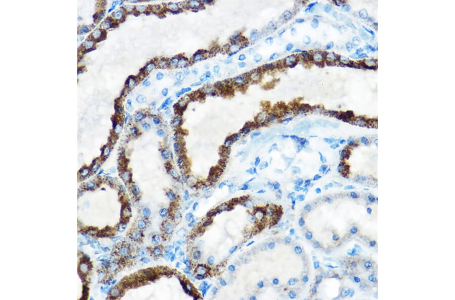 Immunohistochemistry - Anti-ornithine aminotransferase Antibody (A15120) - Antibodies.com
