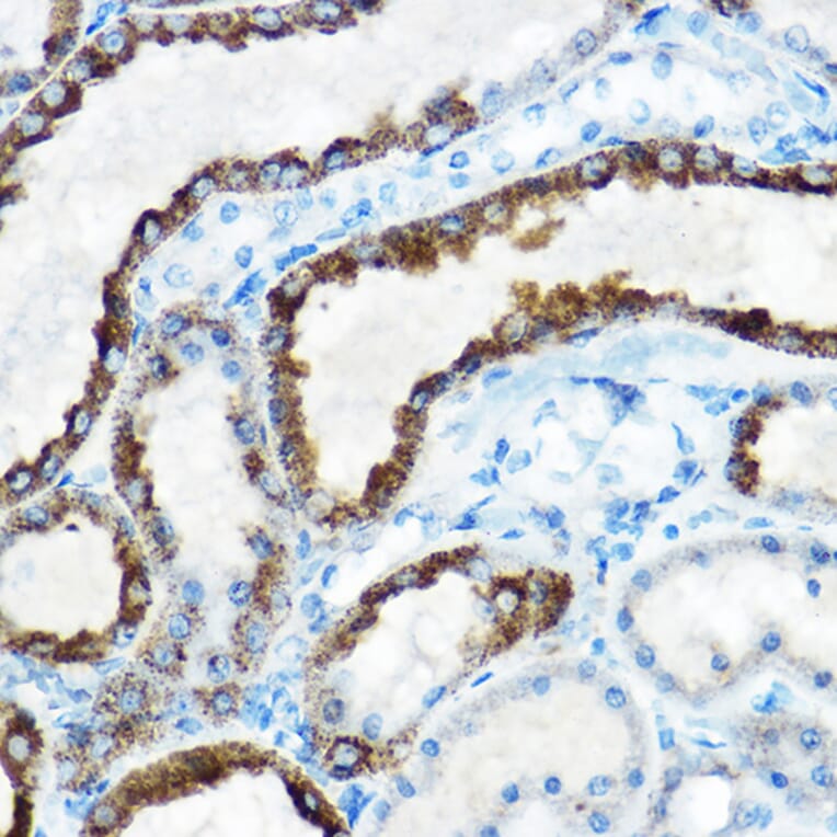 Immunohistochemistry - Anti-ornithine aminotransferase Antibody (A15120) - Antibodies.com