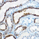Immunohistochemistry - Anti-ornithine aminotransferase Antibody (A15120) - Antibodies.com