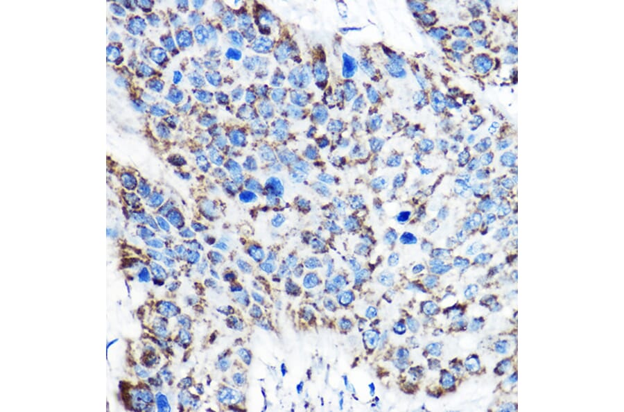 Immunohistochemistry - Anti-ornithine aminotransferase Antibody (A15120) - Antibodies.com