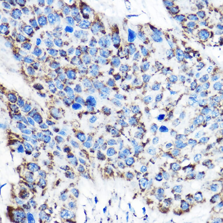 Immunohistochemistry - Anti-ornithine aminotransferase Antibody (A15120) - Antibodies.com