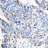 Immunohistochemistry - Anti-ornithine aminotransferase Antibody (A15120) - Antibodies.com