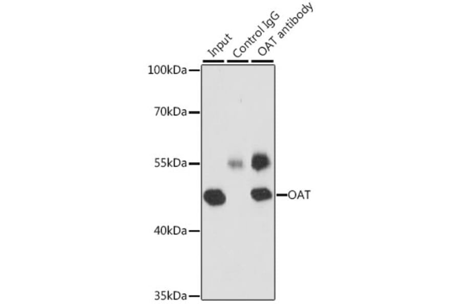 Western Blot - Anti-ornithine aminotransferase Antibody (A15120) - Antibodies.com