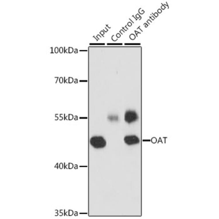 Western Blot - Anti-ornithine aminotransferase Antibody (A15120) - Antibodies.com