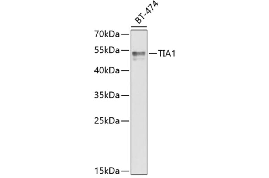 Western Blot - Anti-TIA1 Antibody (A6237) - Antibodies.com