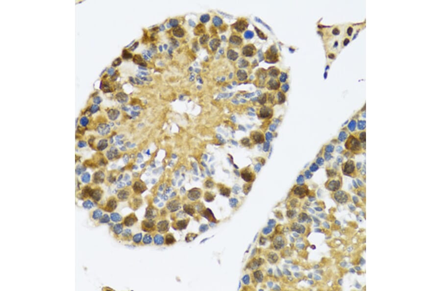 Immunohistochemistry - Anti-TIA1 Antibody (A6237) - Antibodies.com