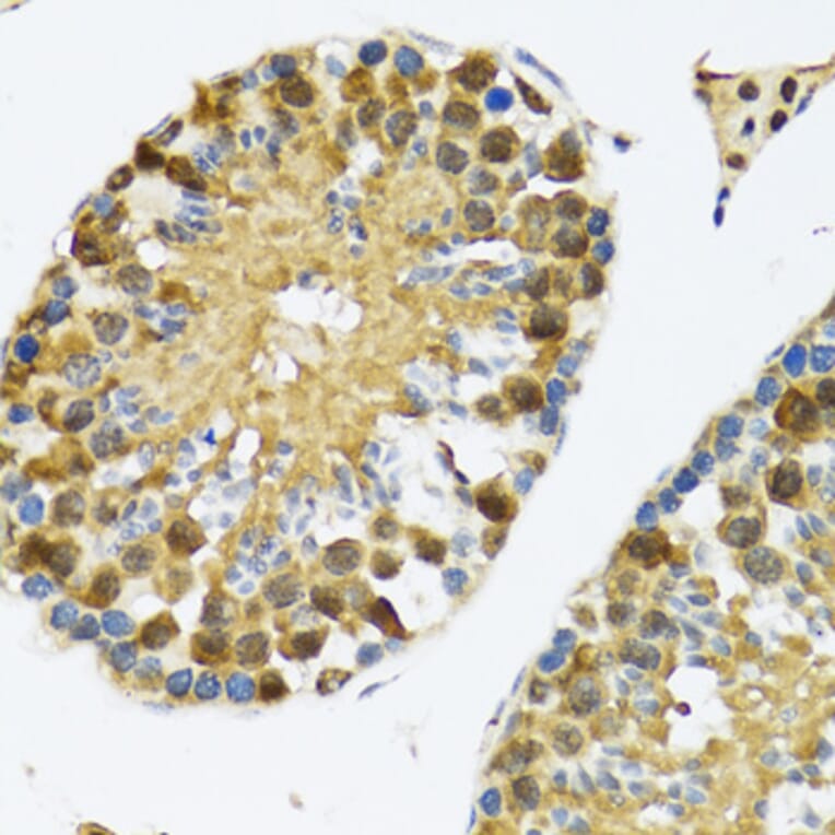 Immunohistochemistry - Anti-TIA1 Antibody (A6237) - Antibodies.com