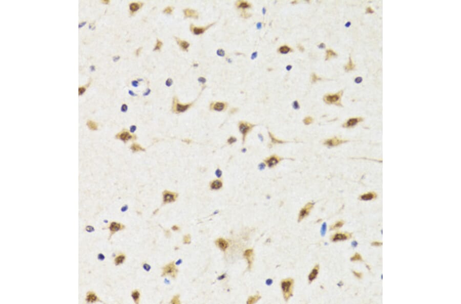 Immunohistochemistry - Anti-TIA1 Antibody (A6237) - Antibodies.com