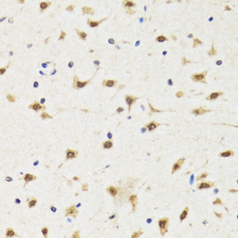 Immunohistochemistry - Anti-TIA1 Antibody (A6237) - Antibodies.com