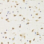 Immunohistochemistry - Anti-TIA1 Antibody (A6237) - Antibodies.com
