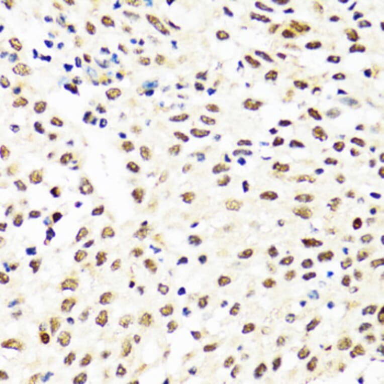 Immunohistochemistry - Anti-TIA1 Antibody (A6237) - Antibodies.com