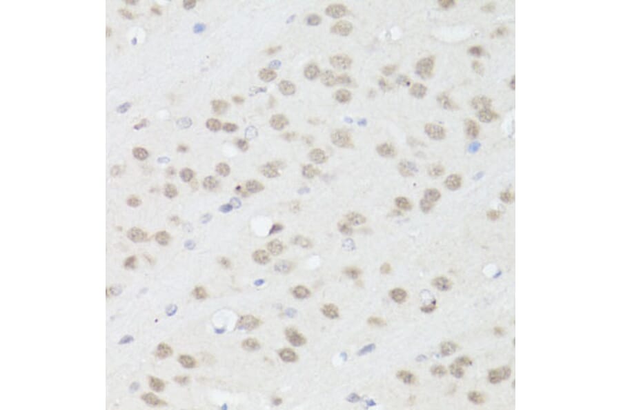 Immunohistochemistry - Anti-TIA1 Antibody (A6237) - Antibodies.com