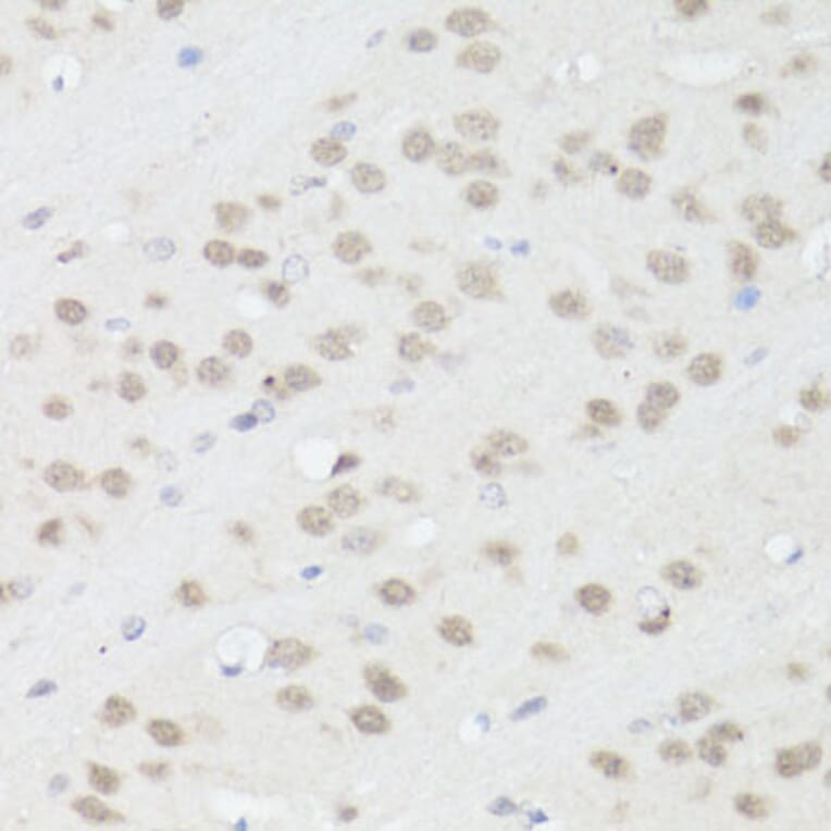 Immunohistochemistry - Anti-TIA1 Antibody (A6237) - Antibodies.com