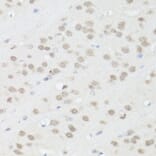 Immunohistochemistry - Anti-TIA1 Antibody (A6237) - Antibodies.com