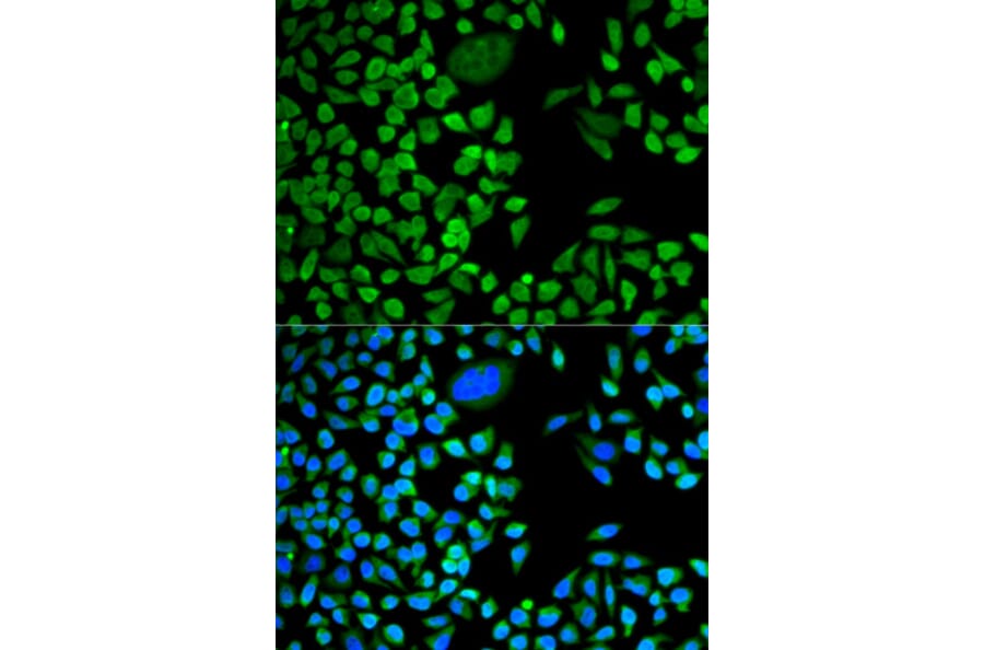 Immunofluorescence - Anti-TIA1 Antibody (A6237) - Antibodies.com