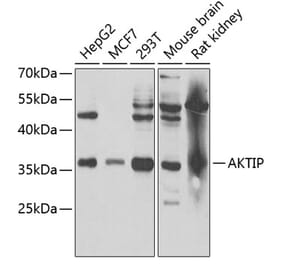 Western Blot - Anti-FTS Antibody (A15122) - Antibodies.com