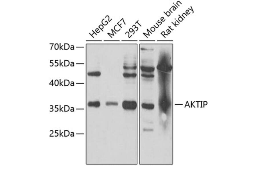 Western Blot - Anti-FTS Antibody (A15122) - Antibodies.com