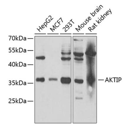 Western Blot - Anti-FTS Antibody (A15122) - Antibodies.com