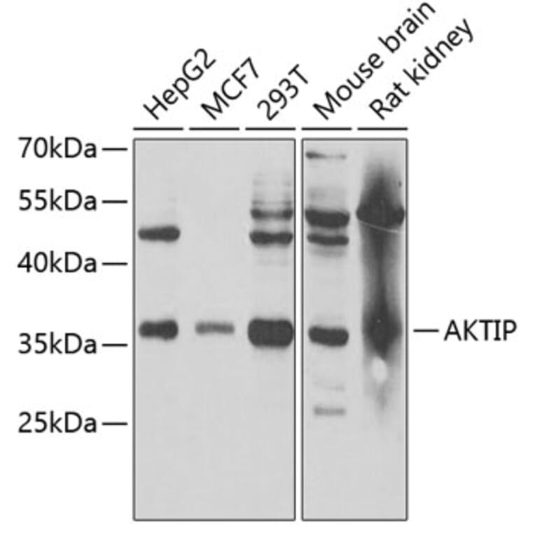 Western Blot - Anti-FTS Antibody (A15122) - Antibodies.com