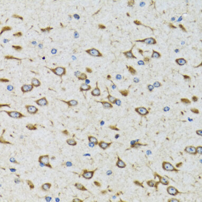 Immunohistochemistry - Anti-FTS Antibody (A15122) - Antibodies.com